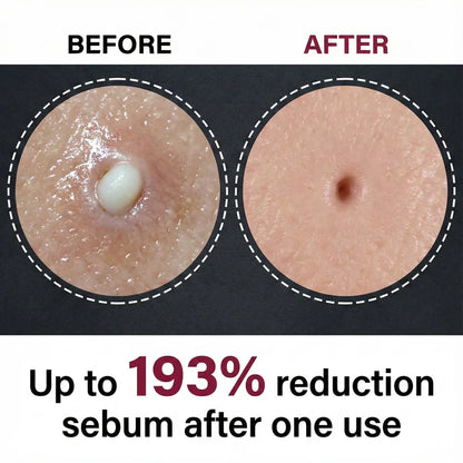 Dr Melaxin Peel Shot Glow Rice Ampoule Duo™