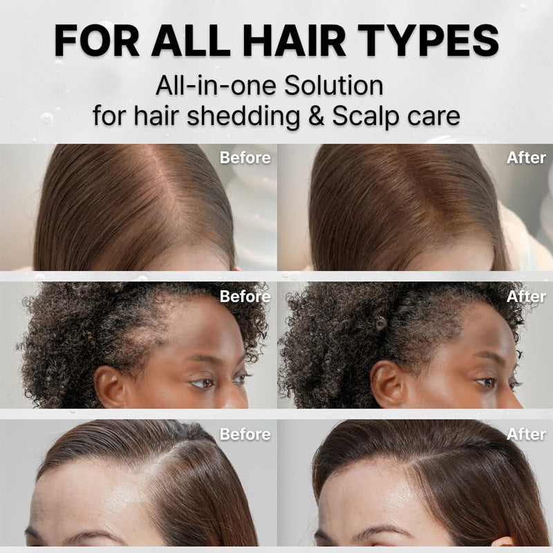 Korea's #1 Hair Growth Serum™