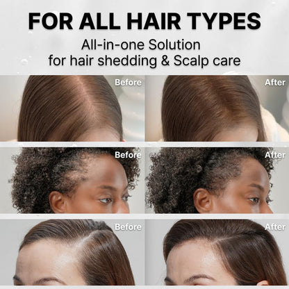 Korea's #1 Hair Growth Serum™