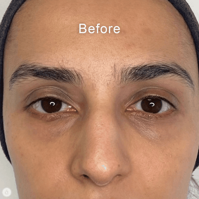 Instant Lift & Brighten Peptide Eye Cream™