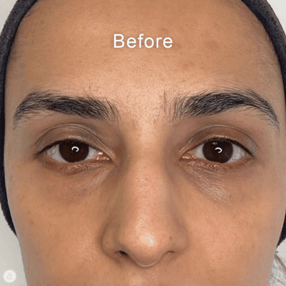 Instant Lift & Brighten Peptide Eye Cream™