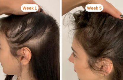 Korea's #1 Hair Growth Serum™