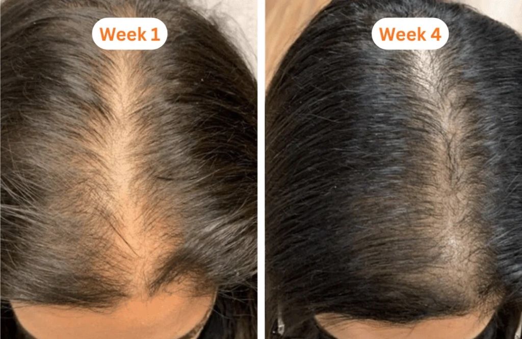 Korea's #1 Hair Growth Serum™