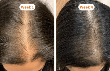 Korea's #1 Hair Growth Serum™