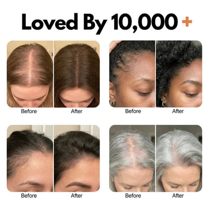 Korea's #1 Hair Growth Serum™