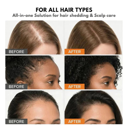 Korea's #1 Hair Growth Serum™