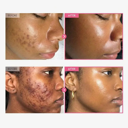 KOREAN Arbutin Brightening Cream