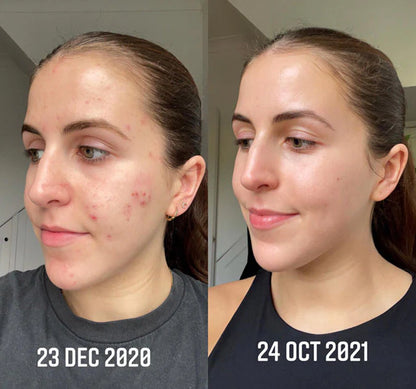 KOREAN Arbutin Brightening Cream
