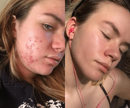 KOREAN Arbutin Brightening Cream